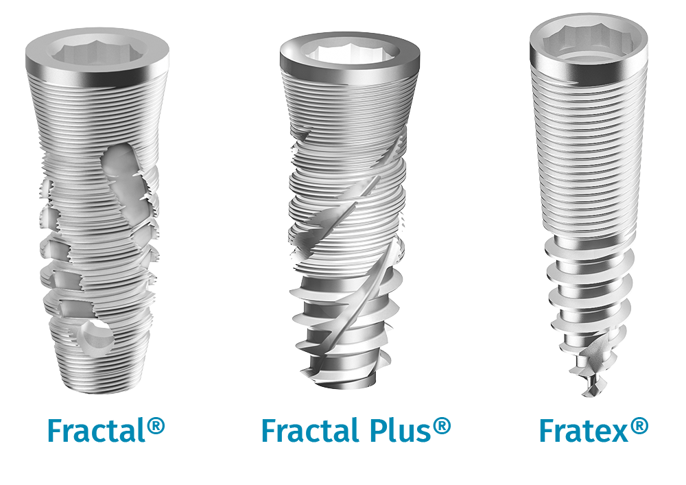 implants-dentaires-1