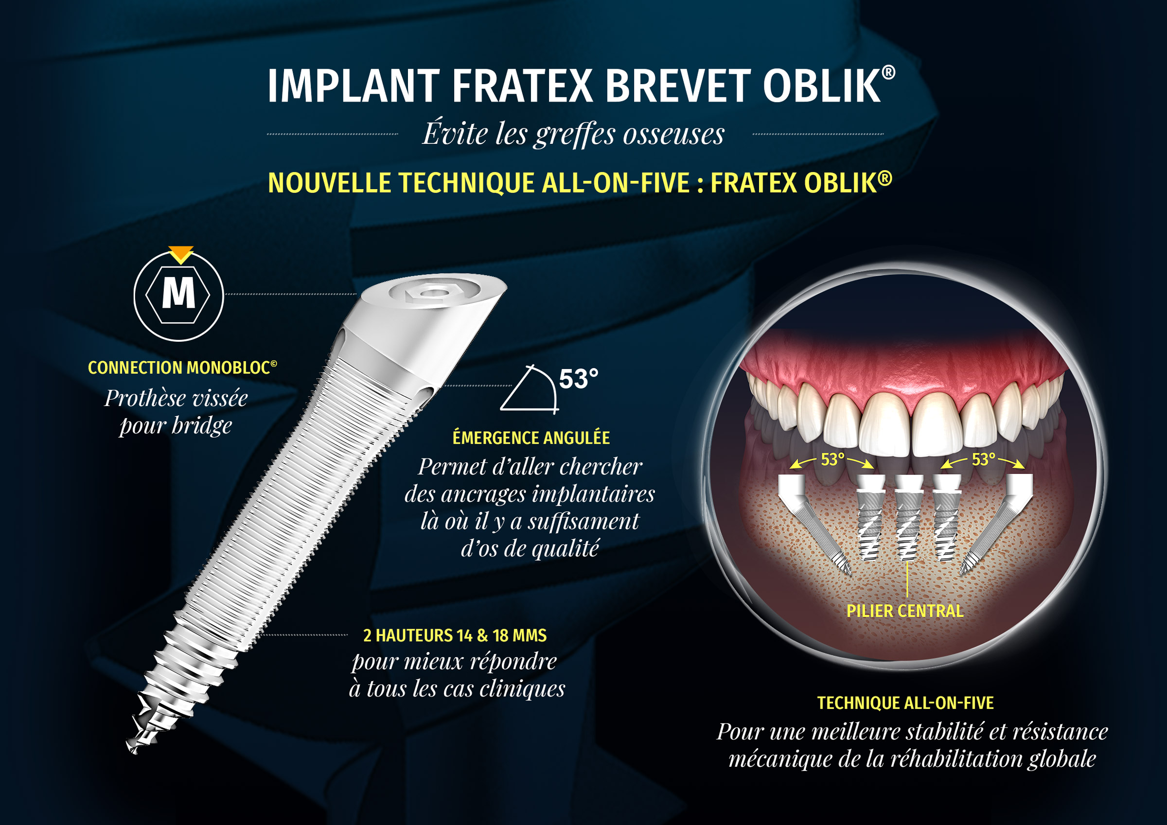 implant-dentaire-FRATEX-OBLIK