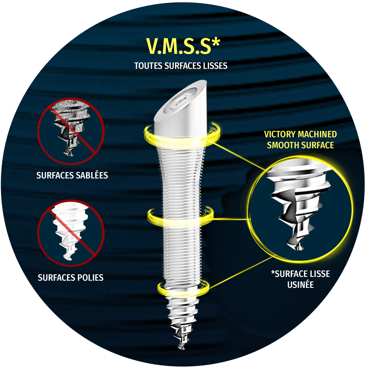implant-surface-lisse-VMSS-oblik