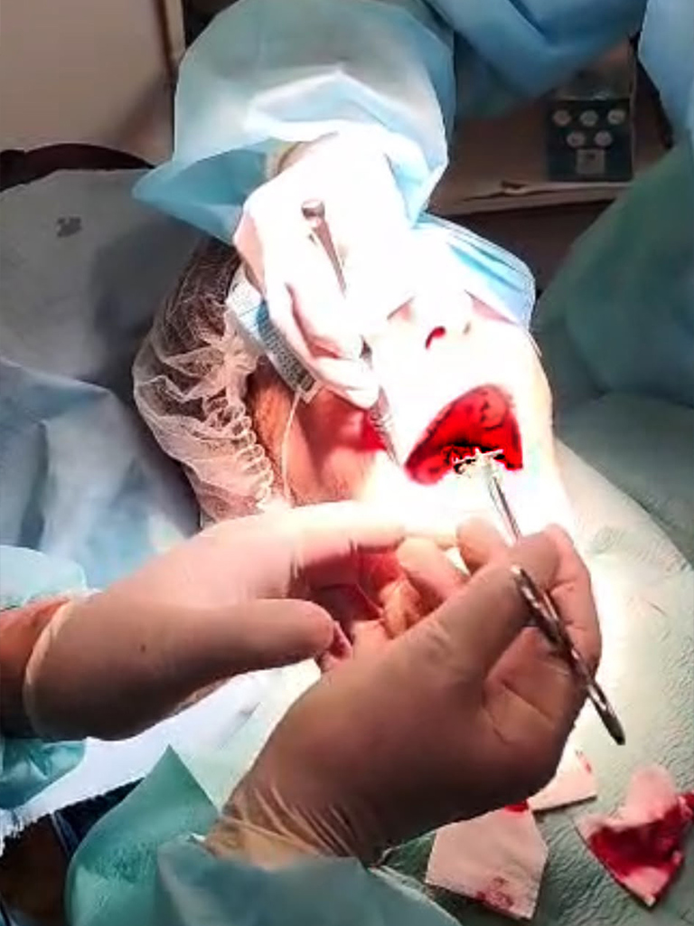 chirurgie-en-direct